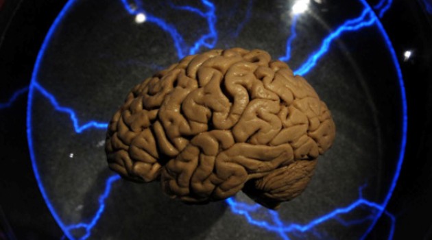 US military awards $40 million toward memory implant/AFP