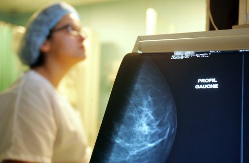 breast cancer