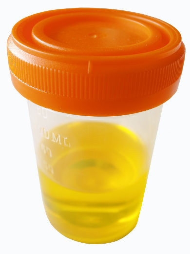 urine