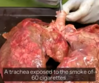 smoking 60 cigarettes