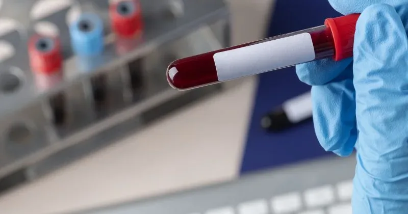 Kenya’s Blood Shortage Crisis Runs Deeper Than a Lack of Donors, Landmark Lancet Study Finds