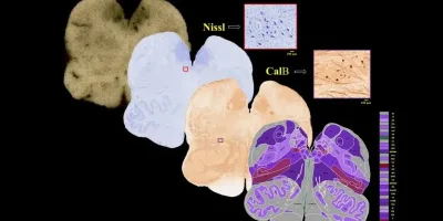 How Indian scientists are mapping the brain’s last frontier