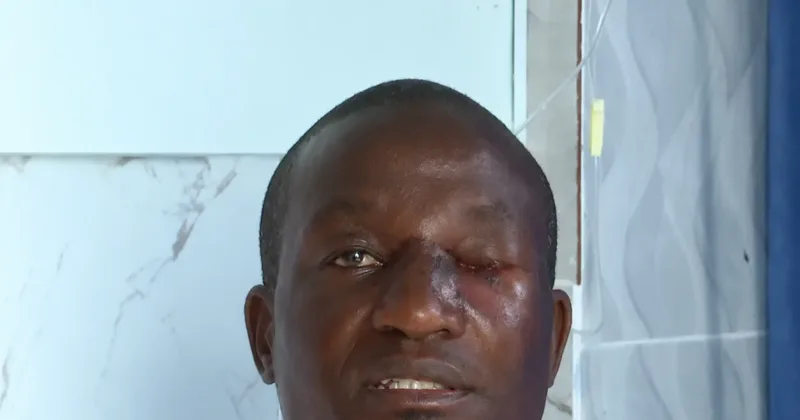 Mediamax Journalist Recounts Homa Bay Attack, Says He Was Injured and Robbed of Camera