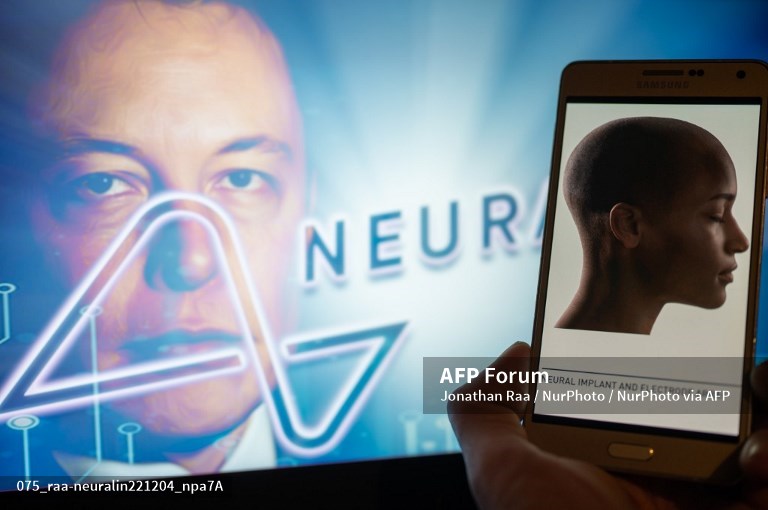 Musk’s Neuralink says cleared for human test of brain implants
