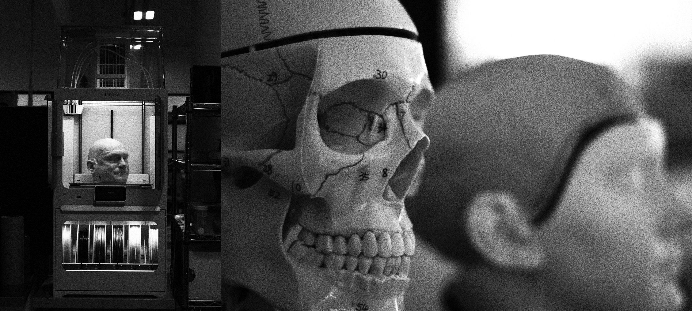 First human receives brain implant from Musk’s Neuralink
