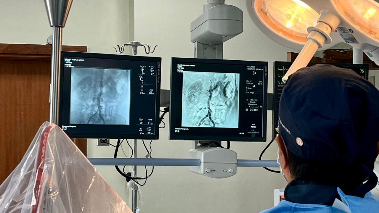 First renal denervation for uncontrolled hypertension done in Kenya
