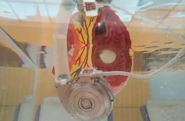 New procedure offers hope for patients with heart conditions