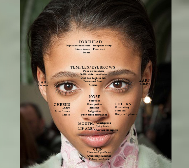 Face Acne