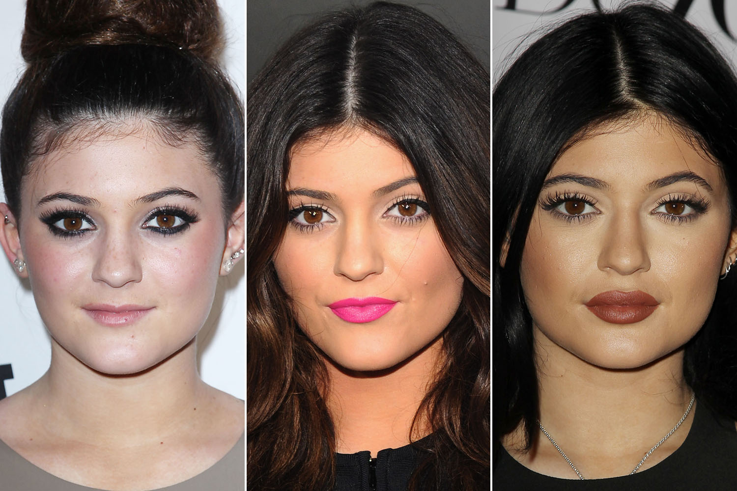 kylie jenner lips