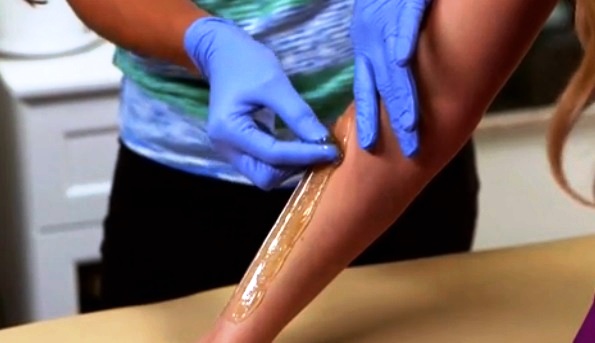 Sugaring hair removal