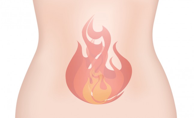 heartburn
