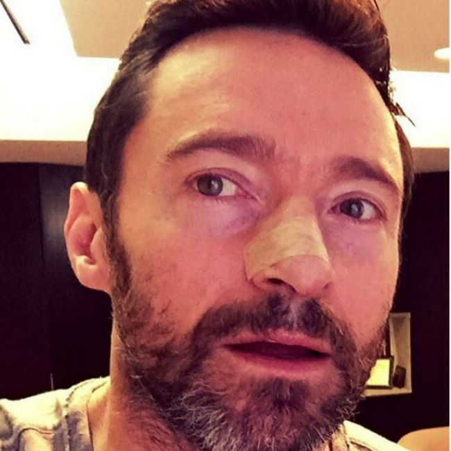 Hugh Jackman