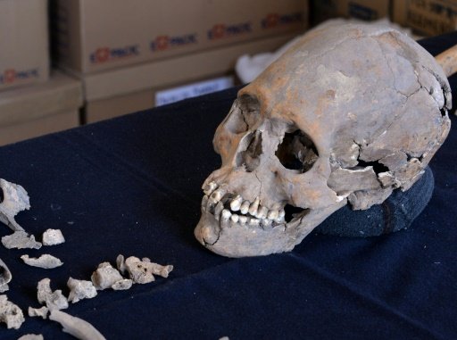 Skeleton teeth