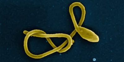 Ebola treatments trial begins in the Democratic Republic of Congo