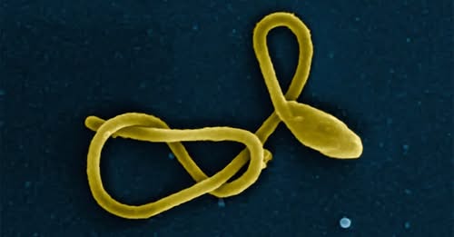 Ebola Cases Surge Past 1,000 in DR Congo as Outbreak Intensifies